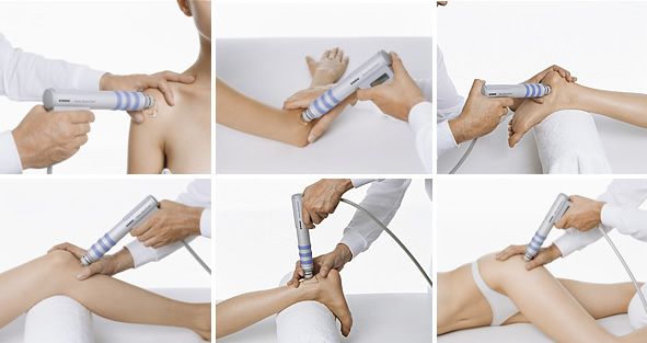 werking shock wave therapy